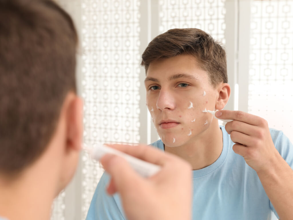 Acne treatment - skincare for guys in Tennessee