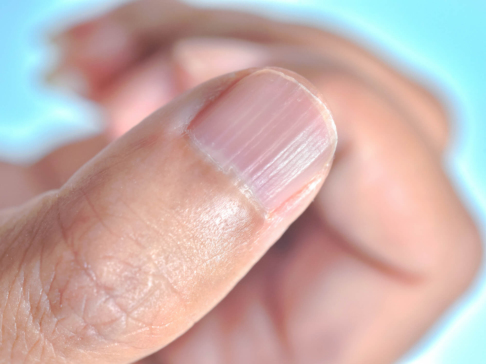 Online dermatology for nail health