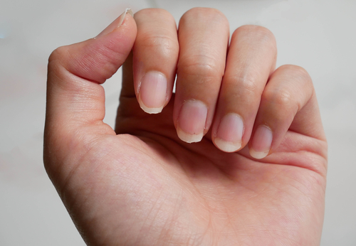 Brittle nails from menopause. Get an online consultation in Nashville, Franklin, and all of Tennessee from a registered nurse.